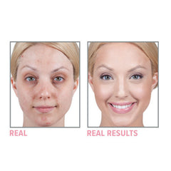 Face make